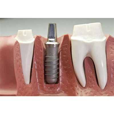 Inductive Bone Regeneration Capability Inductive Bone Regeneration Capability