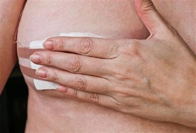 Rinna ultraheliga juhitav südamik nõela biopsia