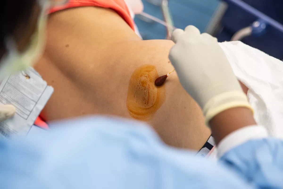 Luuüdi biopsia selgitas: protseduur, kasutamine ja taastumine
