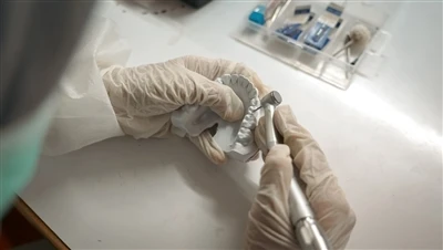 Trokaarite kasutamine laparoskoopilises kirurgias